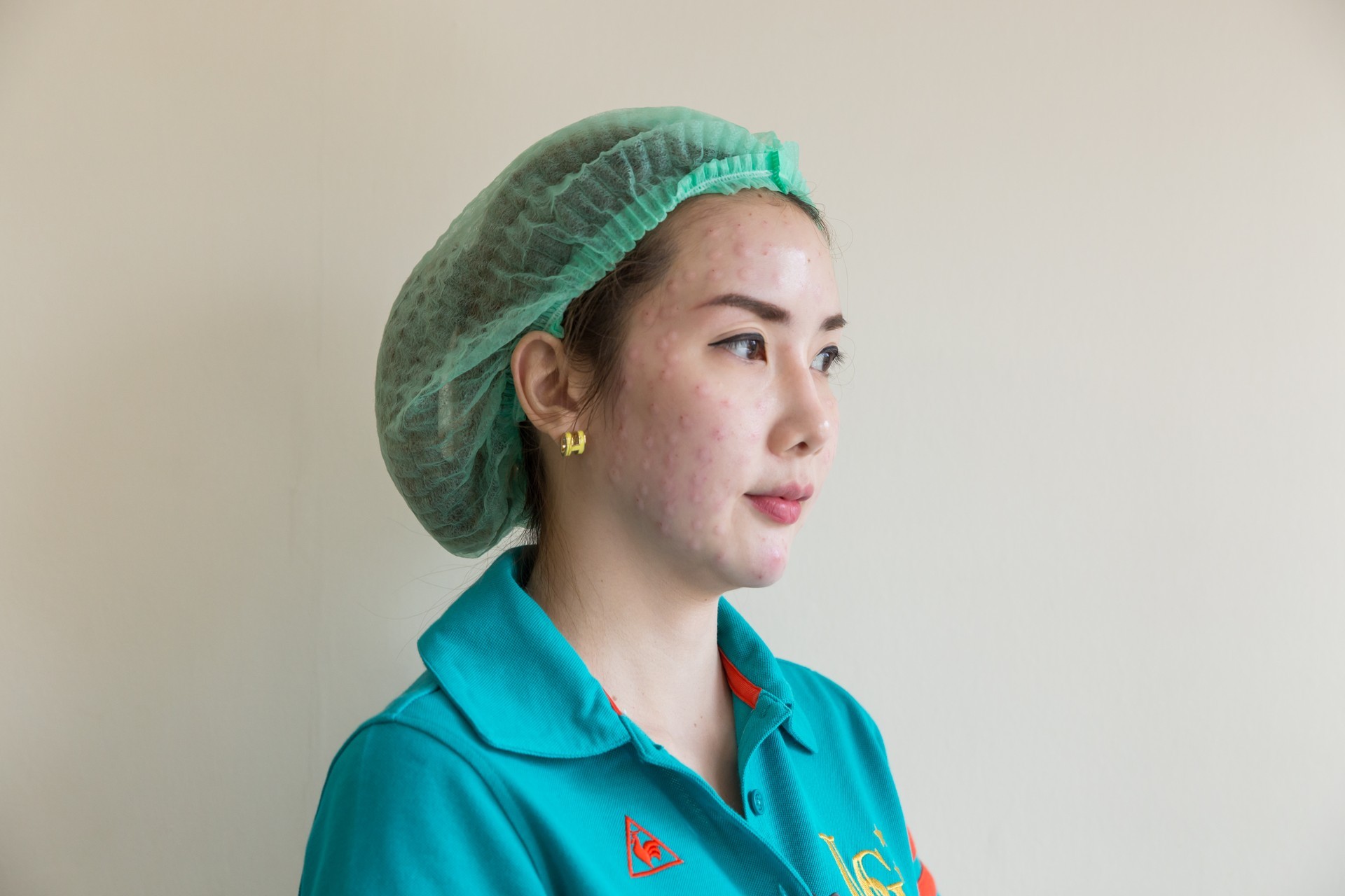 หน้าใส,ผิวขาวใส