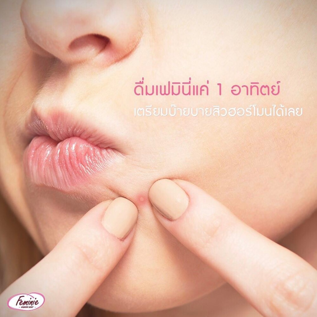 “Feminie” ไอเท็มใหม่ ช่วยให้สิวไม่ขึ้นก่อนมีประจำเดือน