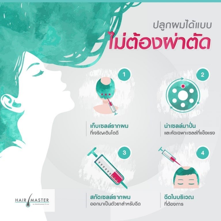 ปลูกผม