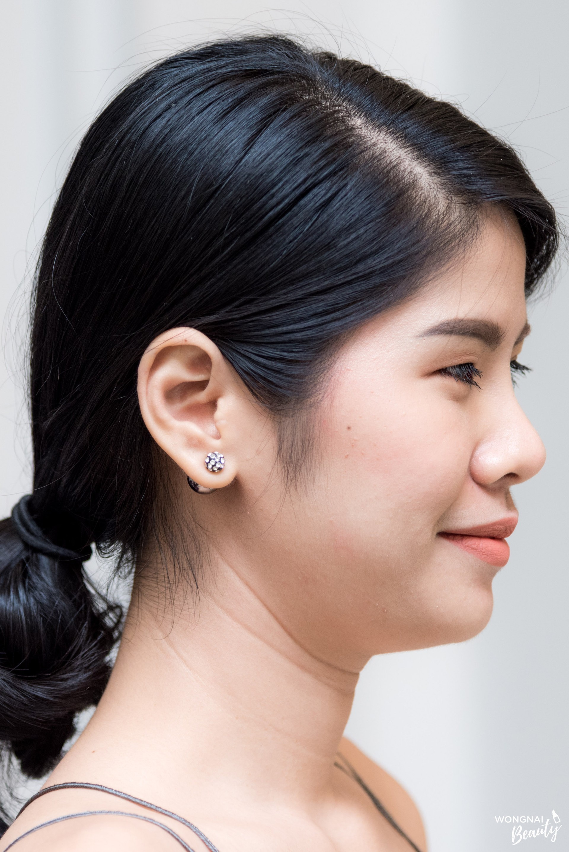 บอกลา 'เหนียง' ด้วยนวัตกรรมสลายไขมันบนใบหน้าแบบใหม่!