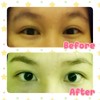 Before-After