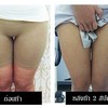เปรียบเทียบให้เห็นกันเลยค่ะ กับภาพ ก่อนทำหลังทำ 