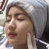 ไม่เจ็บเลยค่ะสบายสบาย