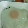 ปากหม้อไข่ดาวสำหรับคนที่ชอบไข่มะตูม