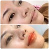 สักปากส้ม/ชมพู เพื่อปากดูมีสุขภาพดี สวย ได้รูป แก้ปากคล้ำปากซีดได้ 