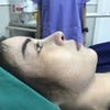 รูปหลังทำทันที (รอบสอง)