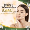 โปรโมชั่น ร้อยไหม + โบท็อกซ์หน้าเรียว เพียง 5,999.- 
ปล. ไม่มีค่าบริการเพิ่ม