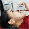 ยกกระชับลิฟท์หน้าด้วย Botox แท้ อย. ปลอดภัย ดูแลโดยแพทย์ แพทย์เตรียมยาให้ท่านเห็