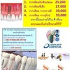 รากเทียม 