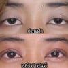ก่อนทำ หลังทำทันที