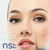 ❗️❗️ฝังเข็มความงามใบหน้า ❗️❗️
📌 ฝังเข็มบำรุงผิว ผิวสวย หน้าใส💁‍♀️
✔ฝ้า กระ
✔ริ