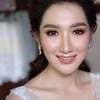 คนไข้เสริมจมูกและคาง