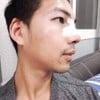 คนไข้หลังผ่าตัดเสริมจมูก