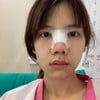 หลังทำทันที
