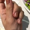 แผลตัดหนัง