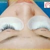 https://www.facebook.com/thailandbeautycenter9/