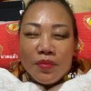 โปรแกรมนวดเปลี่ยนหน้า 