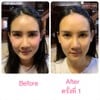 โปรแกรมนวดเปลี่ยนหน้า