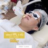 IPL เลเซอร์สิวหน้าใส 3ครั้ง 999