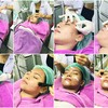 ขั้นตอนการทำ Miami Peel Acne treatment 
