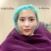 จะเห็นว่าข้างที่ร้อยแล้ว ดูกระชับ หน้าเรียวสวยขึ้นทันทีเลยค่ะ 