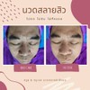  รีวิวก่อนนวดและหลังนวด