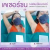 เลเซอร์ขน