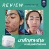 มาร์กสาหร่ายลดสิว ที่พี่กุ้งกดสิวเเนะนำ