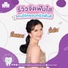 รีวิวคนไข้ที่น่ารัก จากครอบครัวฟันดี