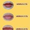 สักปากเมื่อไหร่หาย