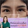 ก่อน-หลังออกแบบชั้นตา