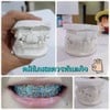 กรณี ศึกษา (เคสฟันซ้อน)
ลูกค้า บางท่าน ทันตแพทย์จะจัดฟันเรียงเรียบ ประมาณ 3-5 เ