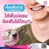 ใส่ฟันปลอมจัดฟันได้ไหม