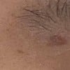 ไหม้บริเวณหัวคิ้ว ยิงหัวไม่สนิทผิว แล้วบอกว่าเกิดขึ้นได้ แต่ทำกับที่อื่นมาไม่เคย