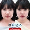 โปรแกรม Oligio 🧏🏻‍♀️