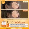 รีวิว หลังฉีดโบท็อกซ์