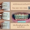 #จัดฟัน #คลินิกสมควรทันตกิจ

เปิดให้บริการทุกวัน 9.00-19.00 น.

☎️085-995-9988

