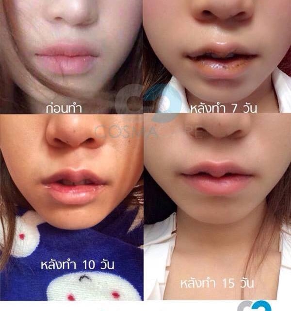 Cosmacare Clinic เลียบทางด่วนรามอินทรา(นวลจันทร์) , ทองหล่อ ซอย 5 , สยามซอย 9 , โลตัส - ศรีนครินทร์ , คริสตัลพาร์ค - เลียบทางด่วนรามอินทรา , โลตัส - วังหิน Cosmacare Clinic เลียบทางด่วนรามอินทรา(นวลจันทร์) , ทองหล่อ ซอย 5 , สยามซอย 9 , โลตัส - ศรีนครินทร์ , คริสตัลพาร์ค - เลียบทางด่วนรามอินทรา , โลตัส - วังหิน
