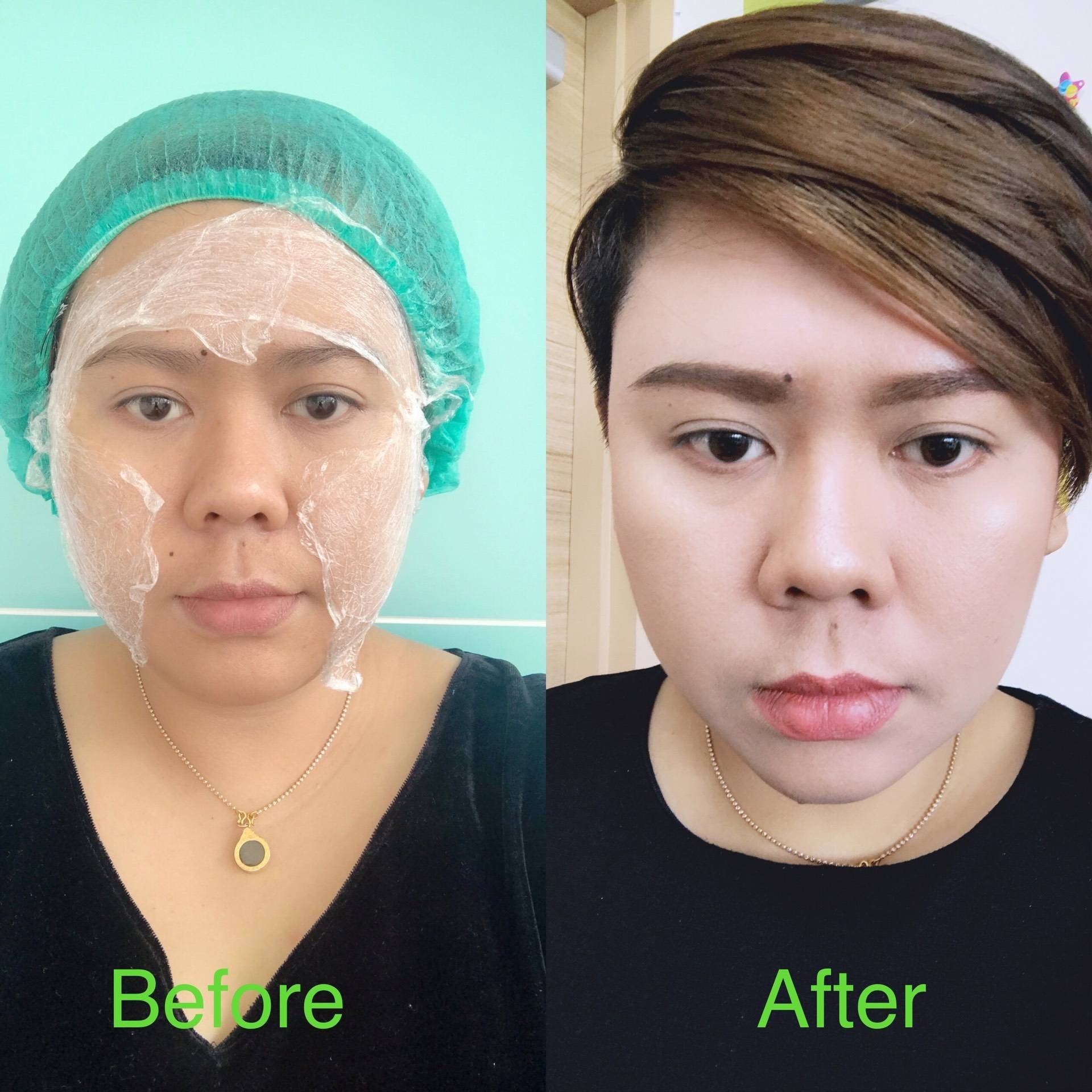 รูป The Wish clinic พัทยา