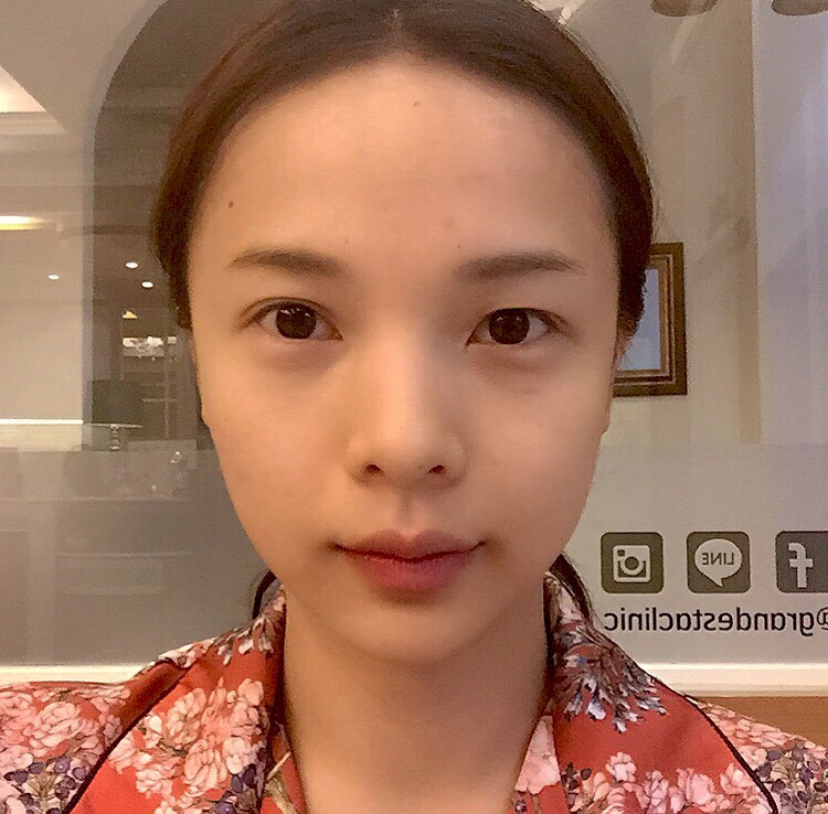 'หน้าแก่' ต้องลองแก้ตามหลัก Facial Design