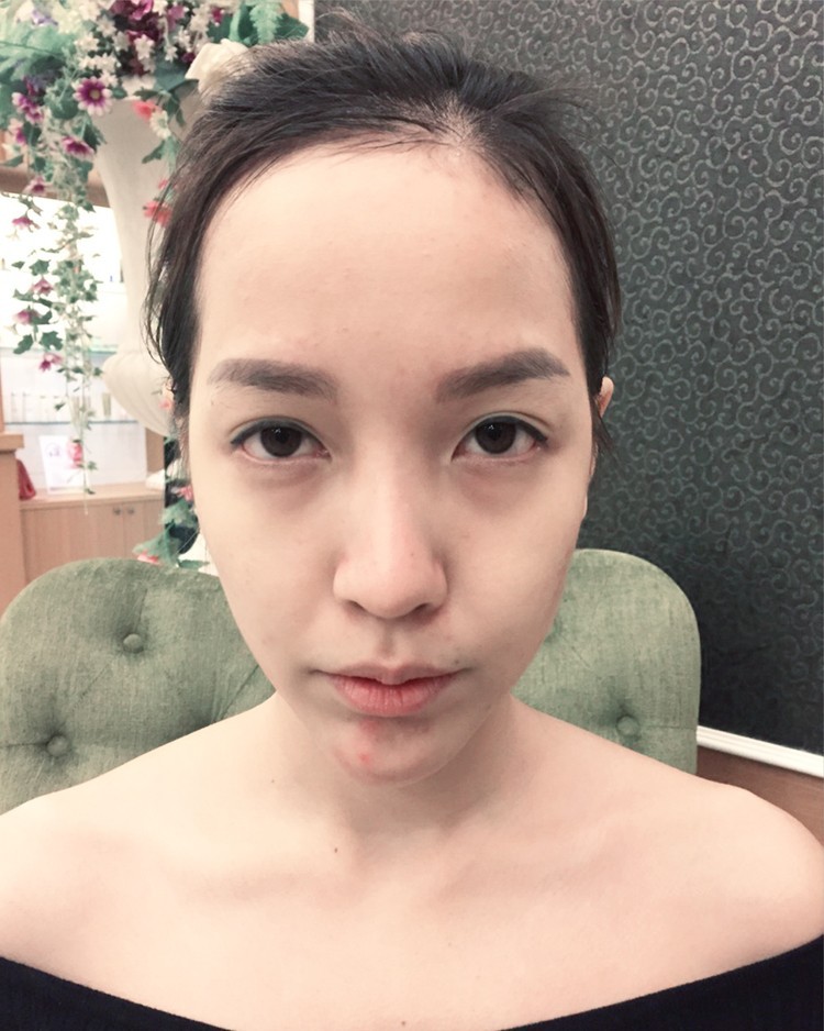 'หน้าแก่' ต้องลองแก้ตามหลัก Facial Design