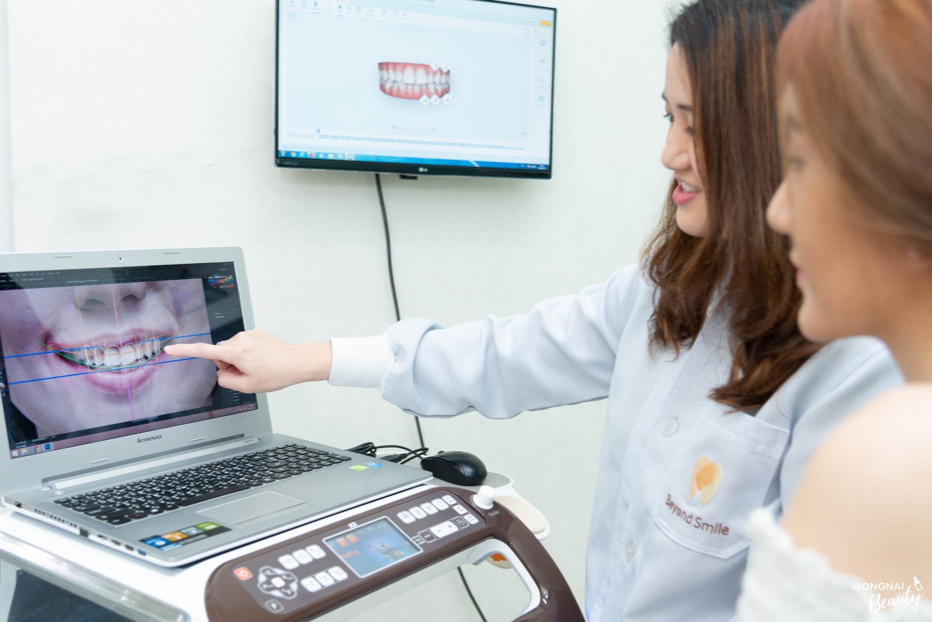 จัดฟันแบบ