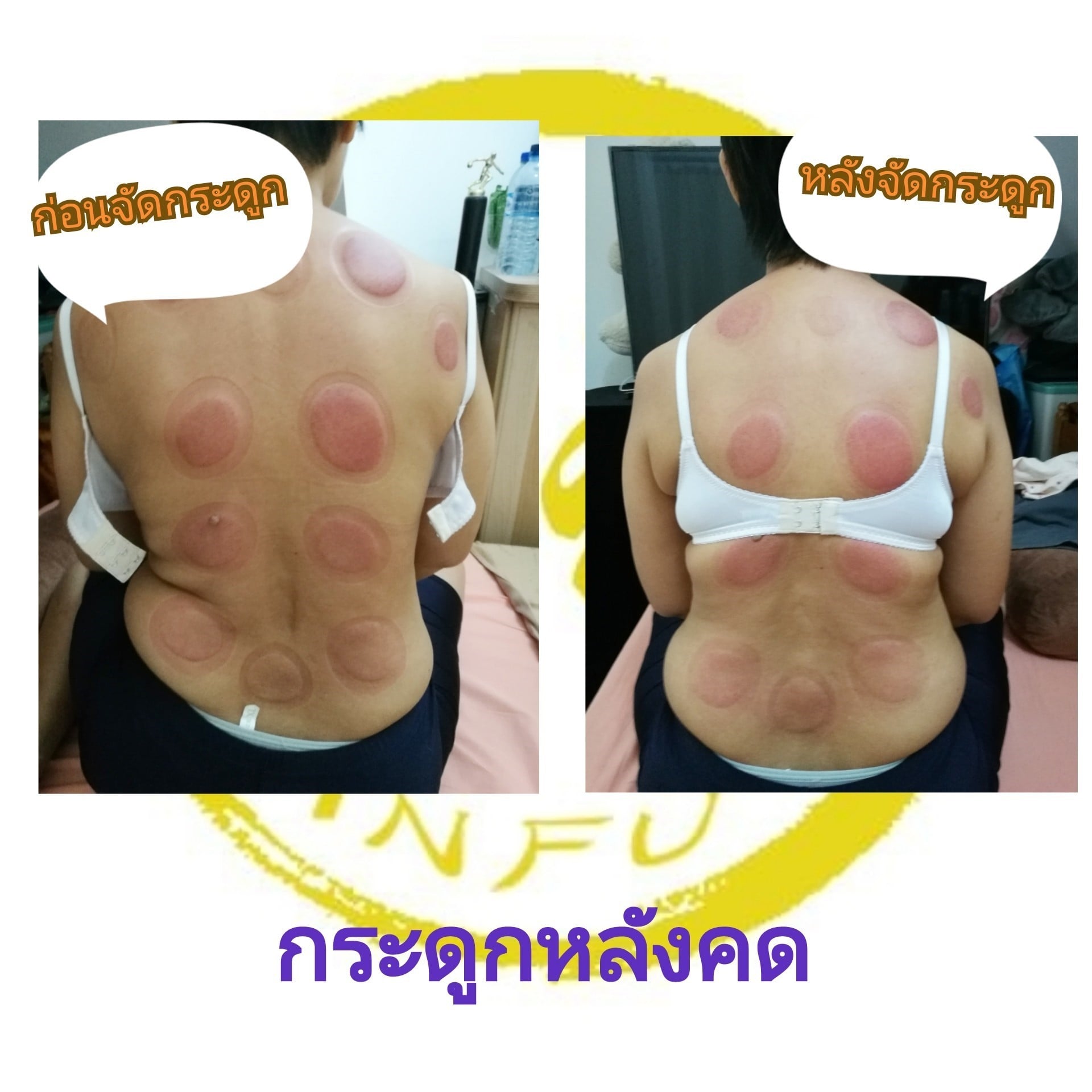 รวมกัน 105+ ภาพพื้นหลัง กระดูกข้อศอกผิดรูป สวยมาก รวมกัน 105+ ภาพพื้นหลัง กระดูกข้อศอกผิดรูป สวยมาก