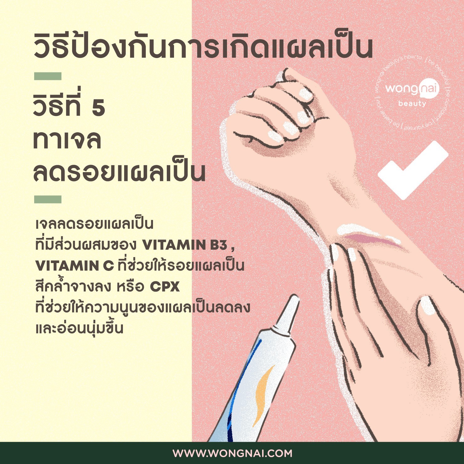 รวมกัน 102+ ภาพ วิธีรักษา รอยแผลเป็นจากการผ่าตัด อัปเดต