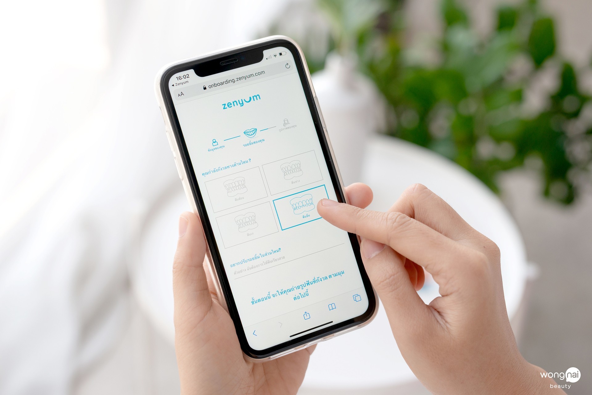 จัดฟันใส Zenyum แก้ฟันเหยิน