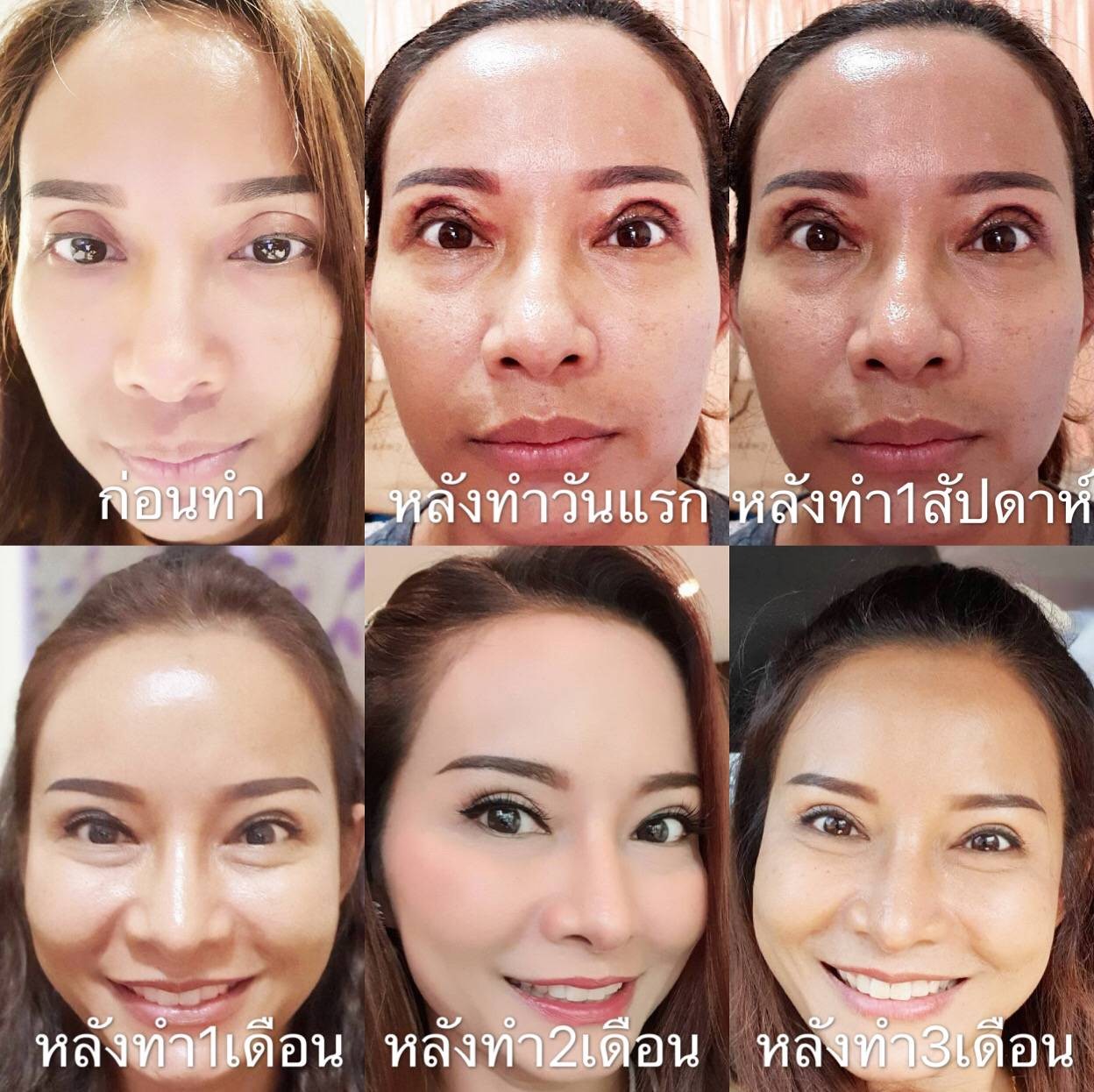 รีวิว จาเรมคลินิก Royal City Avenue [RCA] - จาเรมคลินิก คือคลินิกที่ดู ...