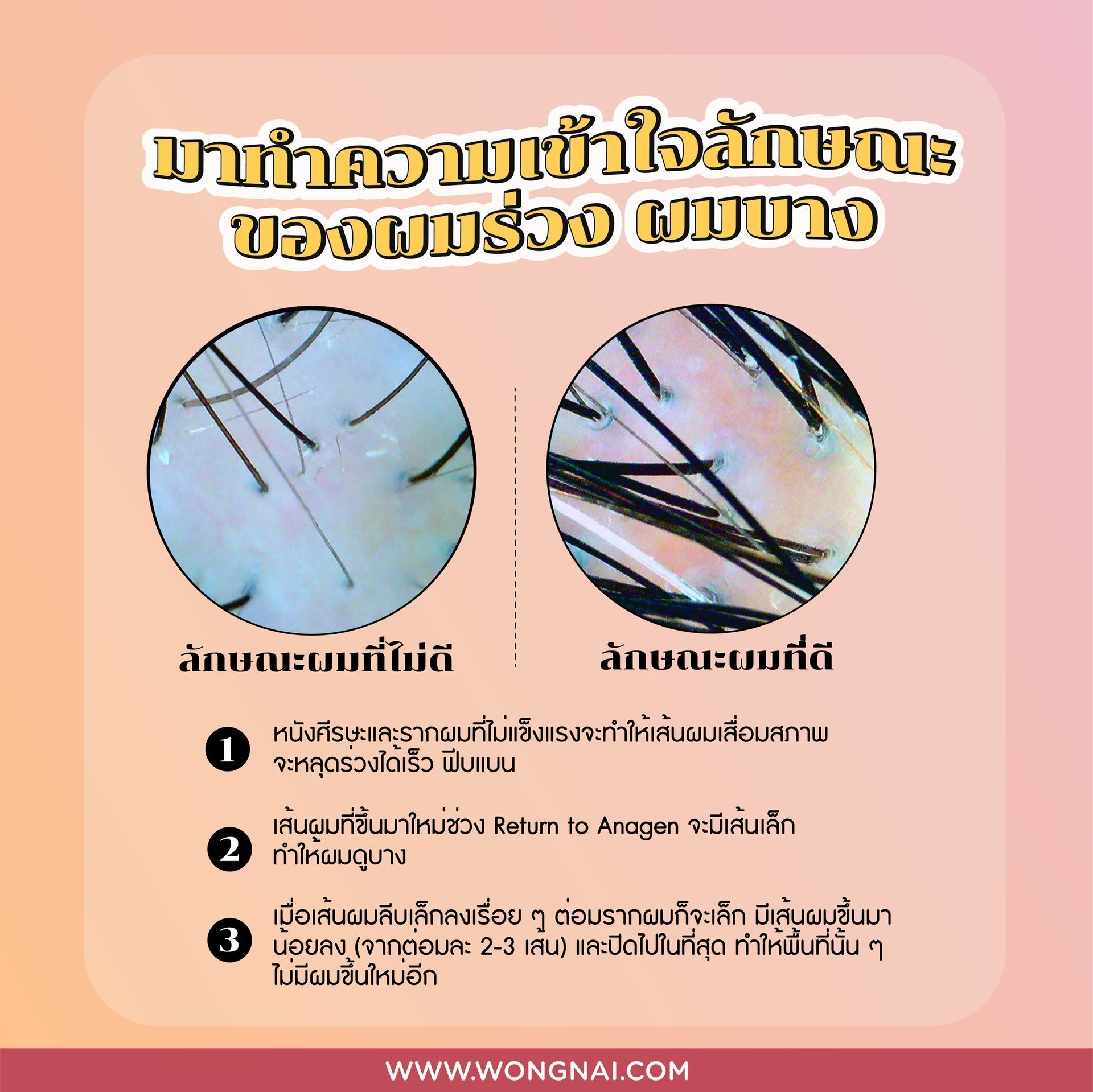 50 Megumi ตัวช่วยหยุดผมร่วง เพิ่มผมหนา แก้ไขได้ใน 16 สัปดาห์ จริงหรือ?