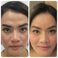 Meko Clinic เซ็นทรัลเวิลด์