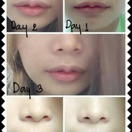 Meko Clinic เซ็นทรัลเวิลด์