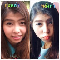 La Grace Clinic เซ็นทรัลชิดลม